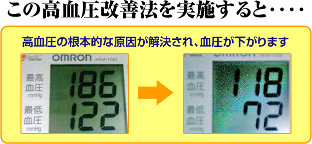 この高血圧改善法を実施すると‥‥高血圧の根本的な原因が解決され、血圧が下がります